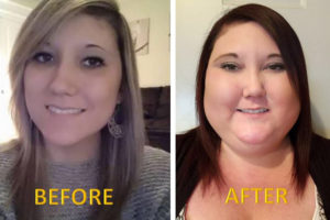 An unknown disease has transformed the appearance of Washougal resident Tessra Ponce, who will be featured on tonight's episode of the TNT show "Chasing The Cure." (Contributed photo courtesy of Tessra Ponce)