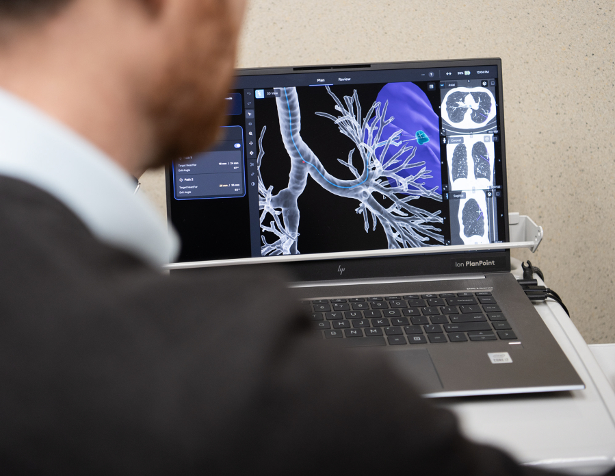 Dr. Nicholas Wysham shows a scan of a nodule in a lung Monday at Vancouver Clinic. Lung cancer is 90 to 95 percent curable if detected early.
