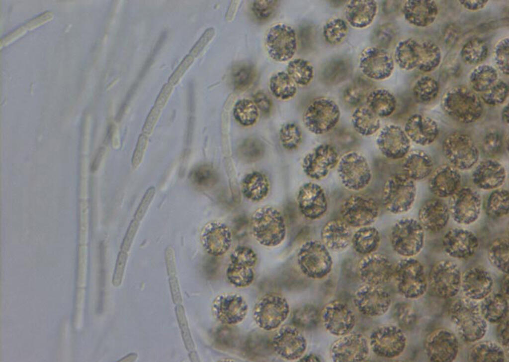 A couple types of cyanobacteria can be seen here under a microscope. These bacteria are becoming more common because of the warming climate.