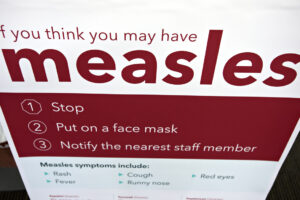 An informational sign about the measles is posted in the entrance of the Kaiser Permanente Cascade Park office Feb. 4, 2019. (Amanda Cowan/The Columbian files)