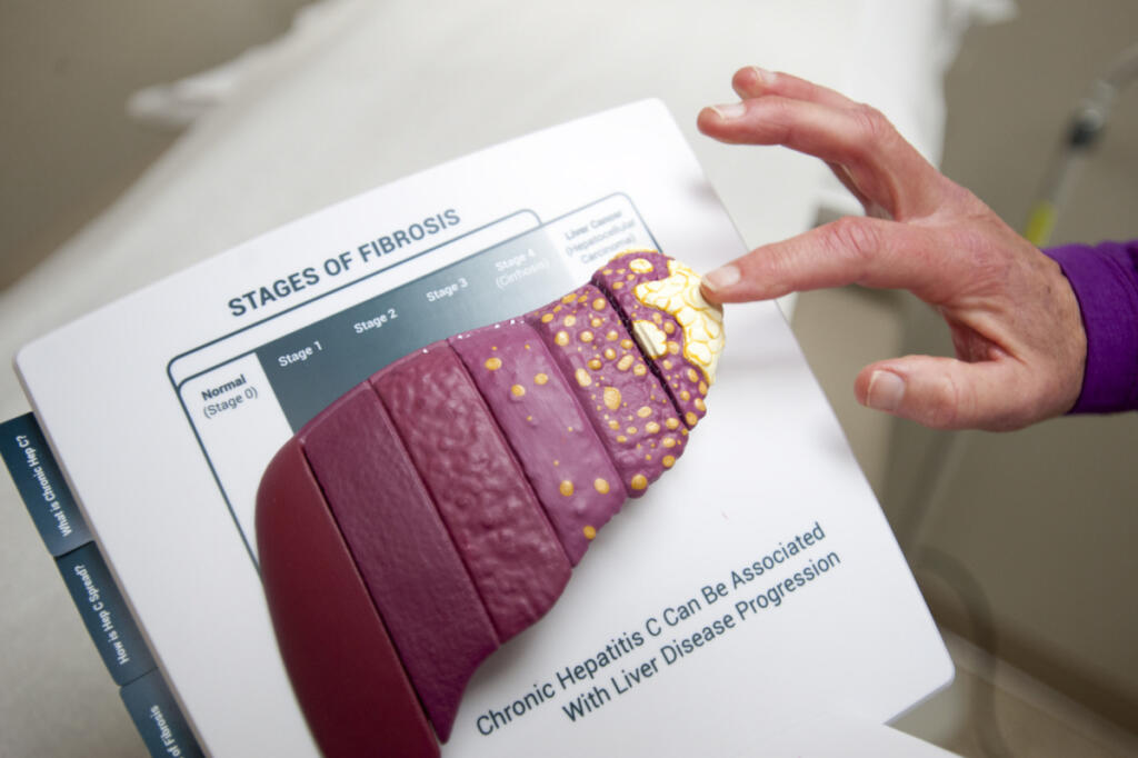 Dr. Sally Williams, an infectious disease doctor, talks about hepatitis C and its effects on the liver at Vancouver Clinic in December 2015. (The Columbian Files)
